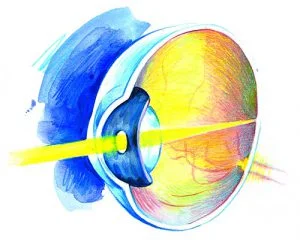 Examination & treatment of presbyopia at the German Eye Clinic Tirana: